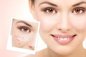 derma plasma pen, blackhead microdermabrasion machine, bio therapeutic microdermabrasion machine,  best personal microdermabrasion machine